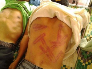 Parishioners show bruises from police beatings during a crackdown on protests in Vietnam's Nghe An province, Sept. 4, 2013.  Photo courtesy of Vietnamese Redemptorists News
