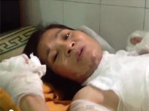 Ngày 04/07/2013, bà Đỗ Thị Thiêm, cư dân khu phố Trịnh Nguyễn – thị xã Từ Sơn, tỉnh Bắc Ninh – bất ngờ bị tạt axit bị thương nặng