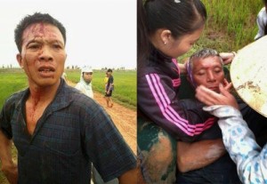 Catholic followers in Du Loc were beaten by local policemen in April