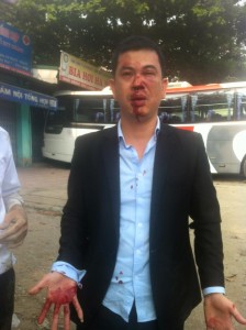 Human rights lawyer Tran Thu Nam beaten by thugs on November 3