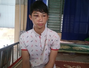 Victim Nguyen Duc Phu still weak after two days under medical treatment.