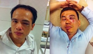 Lawyer Luan (left) and lawyer Nam (right) after being attacked by Chuong My district thugs