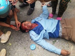 Mr. Pham Duc was beaten by police officers during the suppression in Quang Binh on July 7, 2015