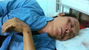 Retired teacher To Oanh is hospitalized after the attack on July 13, 2016