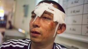 Nhà hoạt động dân chủ Lã Việt Dũng bị tấn công ngày 10 tháng bảy năm 2016. AFP photo Nhà hoạt động dân chủ Lã Việt Dũng bị tấn công ngày 10 tháng bảy năm 2016. AFP photo