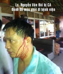 Mr. Nguyen Van Dai attacked with glass by thugs in Hanoi in 2014