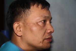 Dai suffered bruising to the face and other injuries during a sustained assault this month