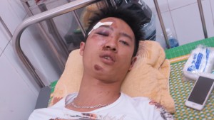 Ho Hai Anh with severe injuries in his head and body after being beaten by mobile police (Courtesy: Dan Tri)